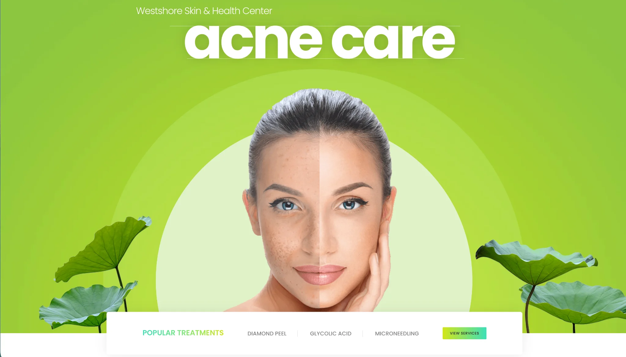 Westshore Skin & Health Center acne care website design